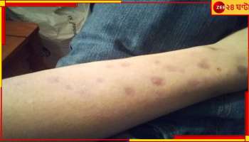 Sonarpur Incident: সারা শরীরে জ্বলন্ত সিগারেটের ছ্যাঁকা! মা-হারা ৫ বছরের খুদেকে নরক-যন্ত্রণা পালিত 'বাবা-মা'য়ের...