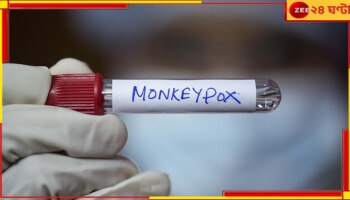 Mpox in India: শান্তি গেল! সবচেয়ে ভয়ংকর Mpox-এর জাতই হানা দিয়েছে ভারতে...