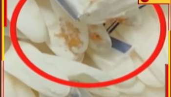 R G Kar: 'সাপ্লাই হল কী করে, আমরা অর্ডারই করিনি'! আরজি কর গ্লাভস কাণ্ডে চাঞ্চল্যকর তথ্য....