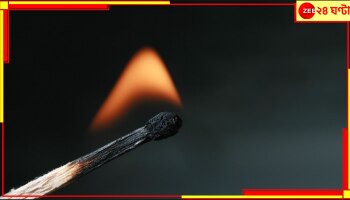 Wife Setting Fire in Face of Husband: জীবন্ত স্বামীর মুখেই আগুন দিলেন স্ত্রী! কেন এই ভয়াবহ কাণ্ড? কোথায় ঘটল?