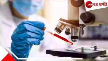 Mysterious Disease: কাশি, বুকে ব্যথা তারপর মৃত্যু! রহস্যময় রোগে মৃত ১৩, ছত্তিশগড়ে আতঙ্ক...