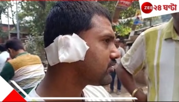 Sonarpur: ভয়ংকর কাণ্ড! শ্যালকের কান কামড়ে ছিঁড়ে নিল জামাইবাবু... 