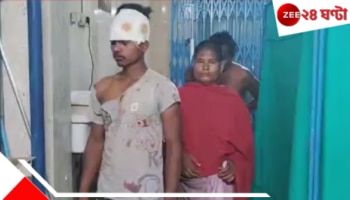 Canning: ভিক্ষুকের কাছেই হাত পাতলেন যুবক! পালটা ধার না দেওয়ায় বেধড়ক মার...