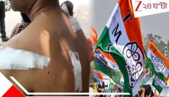 Malda: তৃণমূল পঞ্চায়েত সদস্যের স্বামীকে প্রকাশ্যে দেদার ধারাল অস্ত্রের কোপ! অভিযোগ...