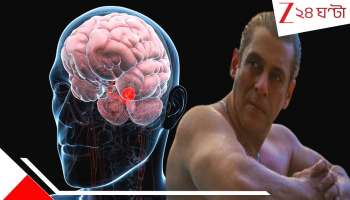 Salman Khan Brain Aneurysm: অ্যানিউরিজম কী, জানেন? সলমান যে ভয়ংকর রোগে আক্রান্ত, তা আপনারও হতে পারে! জেনে নিন, কীভাবে বাঁচবেন এর হাত থেকে...