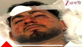 Indian student lynched in Australia: 'ভাগ এখান থেকে! যতই রগড়া, তোরা কালোই থাকবি...' বর্ণদ্বেষী হামলায় মরণাপন্ন ভারতীয় ছাত্র...