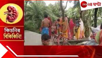 Kidney Trafficking: ১টা দিলেই ৮-১০ লাখ! অভাবের &#039;কিডনি পাড়ায়&#039; অঙ্গ বিক্রির হিড়িক! করছেন একের বেশি বিয়েও...