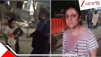 Dog Feeders Brutally Thrashed: 'কুকুরকে খাওয়াচ্ছিলাম, তাই আমার বুকে, গোপনাঙ্গে পর্যন্ত...' প্রৌঢ়াকে মেরে র*ক্তা*ক্ত করে দিলেন আইনজীবী... ভয়ংকর ভিডিয়ো...  