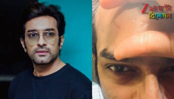 Jeetu Kamal: মেকআপ করতে গিয়ে রক্তারক্তি, মেকআপ আর্টিস্টের বিরুদ্ধে মামলা জীতুর?