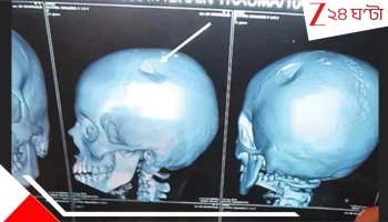 Andhra School Shocker: ব্যাগ তুলে ছোট্ট ছাত্রীর মাথায় মার শিক্ষিকার! স্টিলের টিফিনবাক্সের আঘাতে ফাটল খুলি...