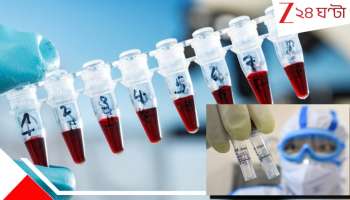 Fresh pandemic warning: খোঁজ নয়া 'বাদুড় ডেরা'র, নয়া স্ট্রেইনে এবার অতিমারী ছড়াবে ইউরোপ থেকে! ভয়াল সতর্কবার্তা বিজ্ঞানীদের...