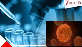 New Global Pandemic: সংক্রমণের হার ৯৭%! কাজ করছে না সাধারণ ওষুধ! ছড়াচ্ছে 'নতুন' ভাইরাস! মহামারীর আশঙ্কা গবেষকদের...