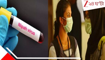 Nipah Virus: ফিরল কোভিডের স্মৃতি? নিপা থেকে বাঁচতে এবার হাসপাতালে গেলেই পরতে হবে মাস্ক! বড় নির্দেশ রাজ্য স্বাস্থ্য দফতরের...