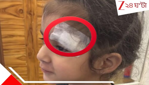 Fevi-Kwik instead of stitches: অবিশ্বাস্য যোগীরাজ্য! হাসপাতালে ২ বছরের খুদের মাথায় সার্জারির পর সেলাই না করে ফেভিকুইক, এ কোন ডাক্তার… Fevi-Kwik instead of stitches: অবিশ্বাস্য যোগীরাজ্য! হাসপাতালে ২ বছরের খুদের মাথায় সার্জারির পর সেলাই না করে ফেভিকুইক, এ কোন ডাক্তার…