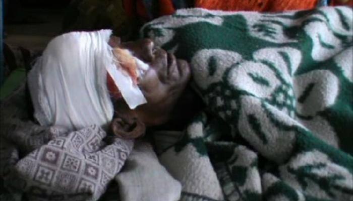 মেয়েকে ধর্ষণের চেষ্টার প্রতিবাদ করায় বাবার চোখ উপড়ে নিল দুষ্কৃতী, ছোট ঘটনা বলল প্রশাসন
