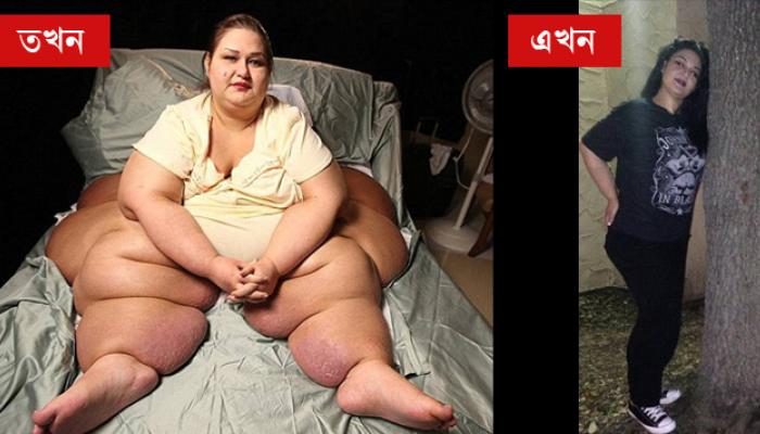 &#039;এভাবেও রোগা হওয়া যায়&#039; সবাইকে শেখালেন বিশ্বের সবথেকে ভারী মানুষ