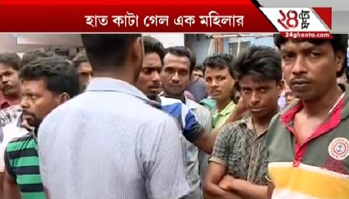 কাকভোরে শোভবাজারে পথ দুর্ঘটনায় হাত কাটা গেল মহিলার