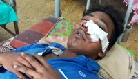 ধার শোধ না করায় নাক কেটে নিল ঋণদাতা!