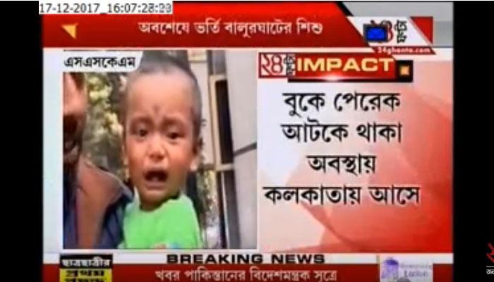 বুকে আটকে পেরেক, তিন-তিনটে হাসপাতাল ঘুরে অবশেষে চিকিত্সা শিশুর