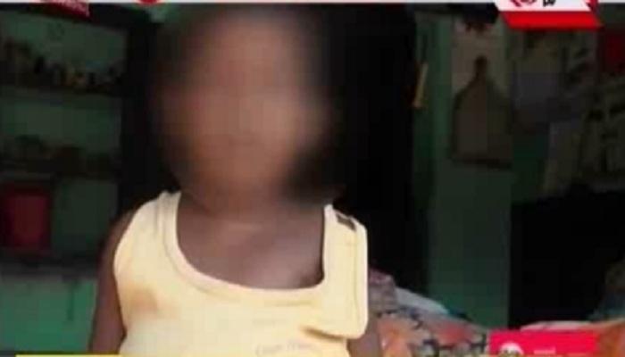 থ্যালাসেমিয়া আক্রান্ত শিশুর শরীরে এইচআইভি! কাঠগড়ায় সরকারি হাসপাতাল