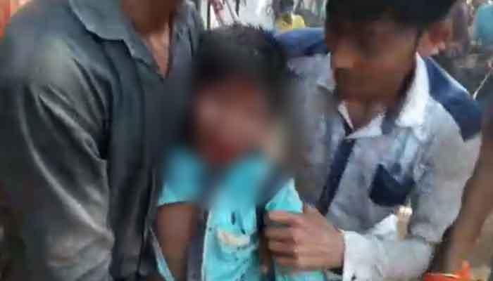 রামনবমীর মিছিল ঘিরে রণক্ষেত্র কান্দি, রক্তাক্ত নাবালক