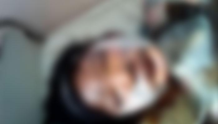 বিয়েতে নারাজ, তরুণীর গায়ে অ্যাসিড-কেরোসিন ঢেলে জ্বালিয়ে দিল যুবক বিয়েতে নারাজ, তরুণীর গায়ে অ্যাসিড-কেরোসিন ঢেলে জ্বালিয়ে দিল যুবক
