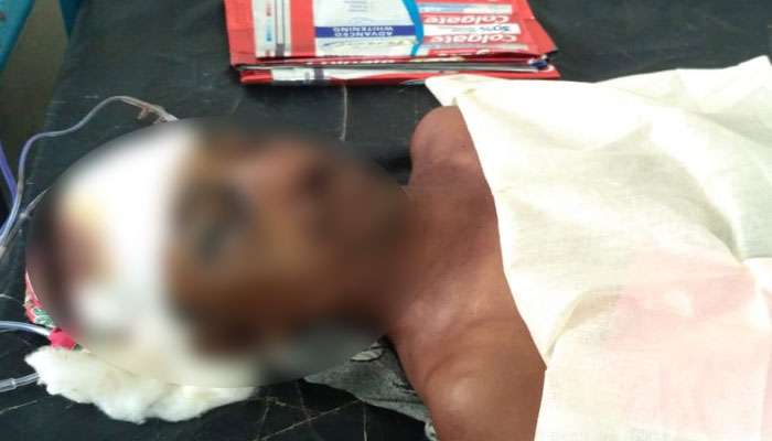 বাইকে ধাক্কার জেরে বিবাদ, তৃণমূল পঞ্চায়েত সদস্যের হাতে 'খুন' তৃণমূল সমর্থক