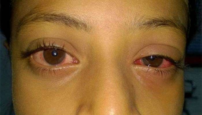 Afrikalik ayollarning porno fotosuratlari mushukda becerdin