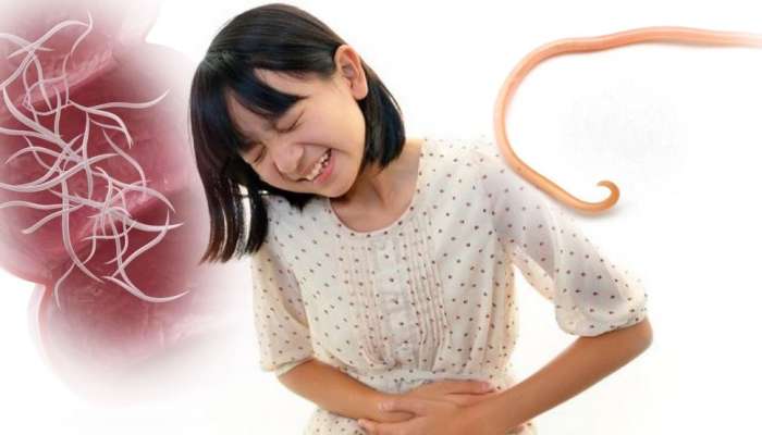 Pinworms - tünetek, diagnózis, kezelés, népi gyógymódok