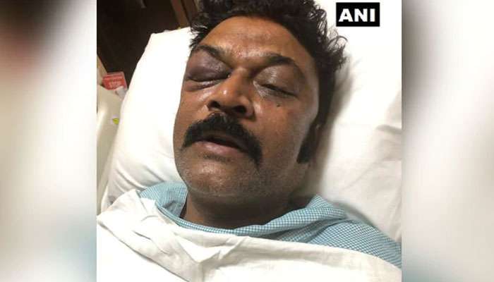 প্রকাশ্যে এল কর্ণাটক কংগ্রেসের অন্তর্দ্বন্দ্ব, বেধড়ক মারধরের অভিযোগ বিধায়ক আনন্দ সিংয়ের