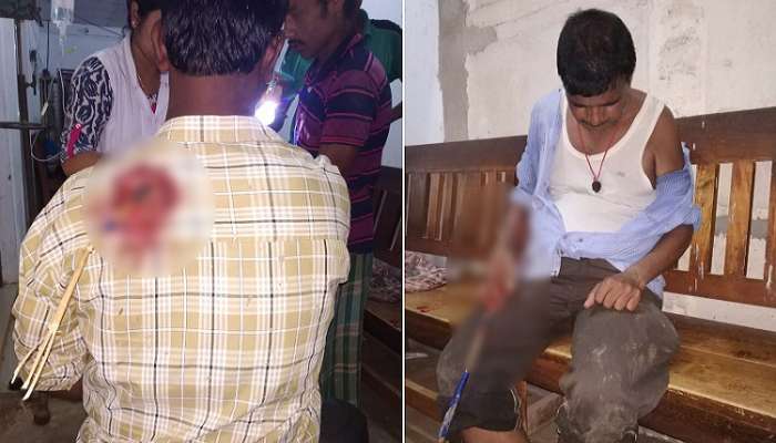 দিনে ভারতী ঘোষের 'কুকুরের মতো' মারার হুমকি, রাতেই তিরবিদ্ধ ২ তৃণমূল কর্মী