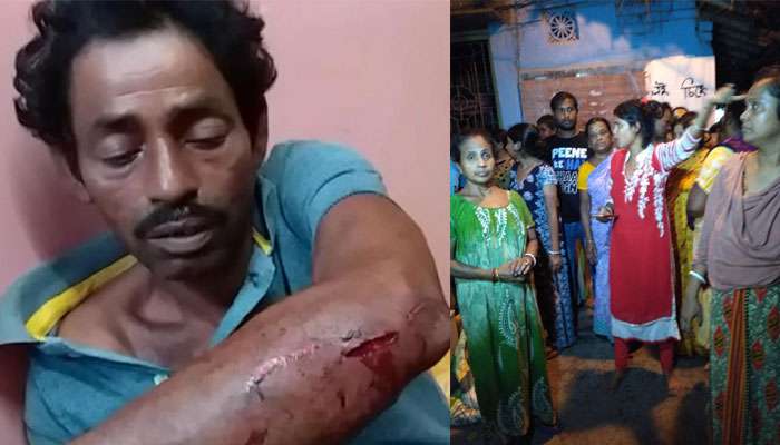 বিজেপি কর্মীর বাবাকে বেধরক মার, গুরুতর জঘম বৃদ্ধ বিজেপি কর্মীর বাবাকে বেধরক মার, গুরুতর জঘম বৃদ্ধ