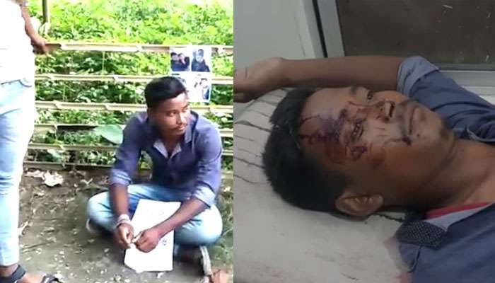 বিয়ের দাবিতে প্রেমিকার বাড়ির সামনে ধরনা, জনতার মারে মাথায় ৫টি সেলাই পড়ল যুবকের বিয়ের দাবিতে প্রেমিকার বাড়ির সামনে ধরনা, জনতার মারে মাথায় ৫টি সেলাই পড়ল যুবকের