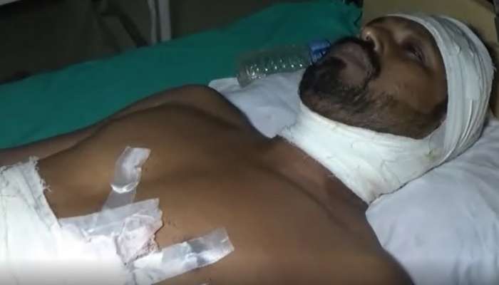 শাসকদলে যোগদানে বাধা! বাইক থেকে নামিয়ে তৃণমূল কর্মীর গলায়, পেটে ক্ষুর হামলা