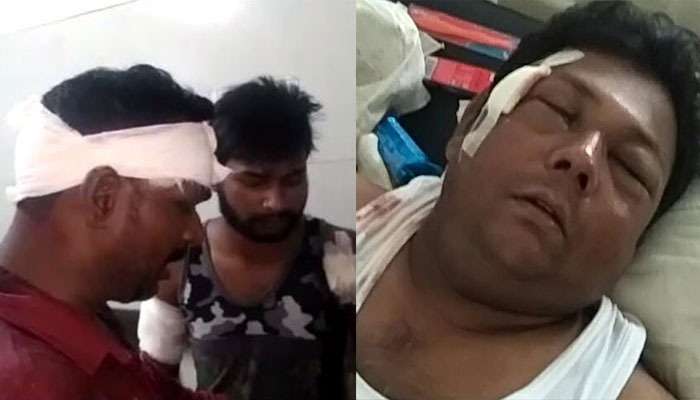 বারুইপুরে মত্ত যুবকদের সংঘর্ষ থামাতে গিয়ে আক্রান্ত সাব-ইন্সপেক্টর বারুইপুরে মত্ত যুবকদের সংঘর্ষ থামাতে গিয়ে আক্রান্ত সাব-ইন্সপেক্টর