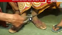 শিকলে বাঁধা ক্যানসার আক্রান্ত মেয়ে, NRS-এ হন্যে হয়ে ডাক্তরের খোঁজ বাবার