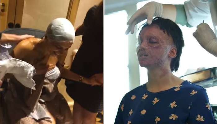 'ছপক'-এর জন্য নিজের চেহারা এভাবেই বদলে ফেলেছিলেন দীপিকা