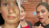 টিকটক ভিডিওতে অ্যাসিড পোড়া 'লুক' চ্যালেঞ্জ, সমালোচনার মুখে দীপিকা