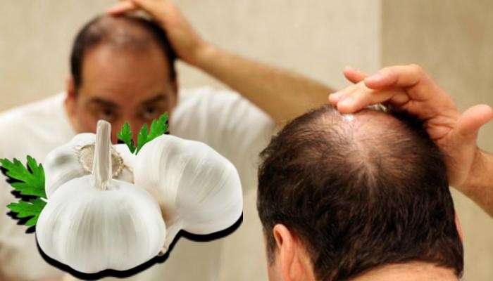 Dabur Vatika Garlic Enriched Hair Oil Review