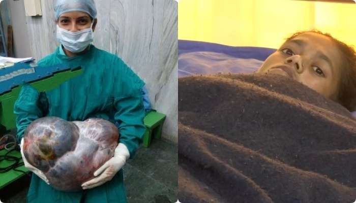 পেট থেকে বের হল ফুটবলের চেয়েও বিরাটাকার টিউমার