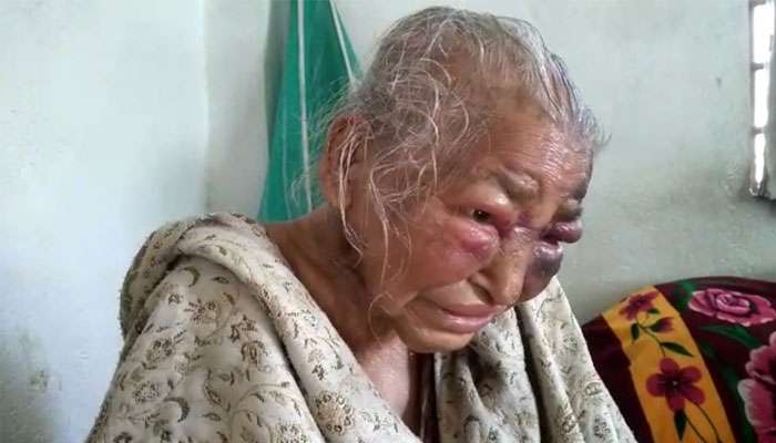 WB Assembly Election 2021: নিমতায় বৃদ্ধার মৃত্যুতে সুবিচার চেয়ে বিক্ষোভ বিজেপির, 'সব বিষয়ে রাজনীতি' পাল্টা TMC