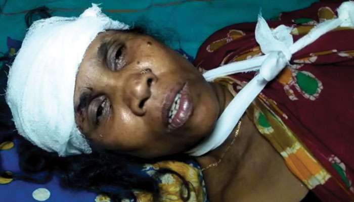 Canning: ধর্ষণের চেষ্টার অভিযোগে পুলিস হেফাজত, ছাড়া পেয়েই গৃহবধূর পরিবারের ৬ জনকে কোপাল যুবক