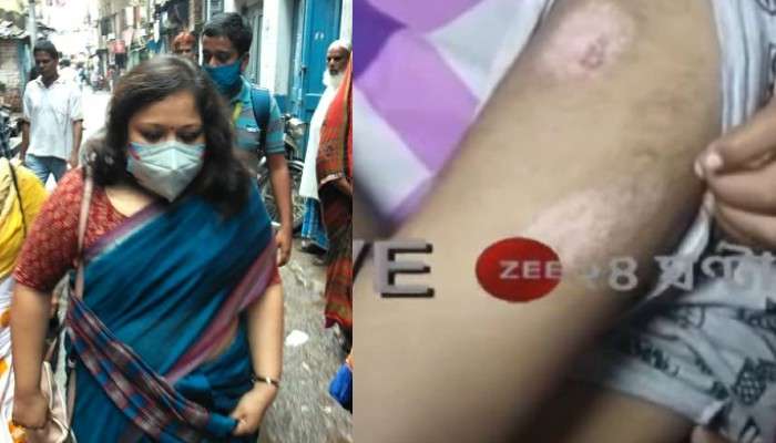 Howrah: ZEE ২৪ ঘণ্টার খবরের জের, আক্রান্ত ছাত্রের বাড়িতে শিশু সুরক্ষা কমিশনের প্রতিনিধিরা 