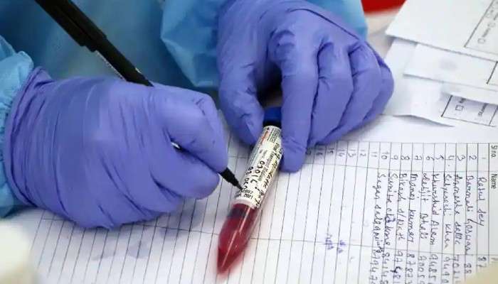 Coronavirus: ৭ মাসে সর্বনিম্ন করোনার দৈনিক সংক্রমণ, মৃতের সংখ্যা কমায় স্বস্তি দেশে