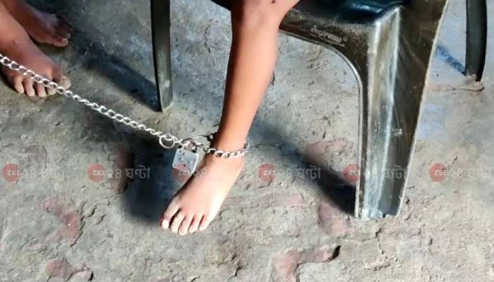 Zee ২৪ ঘণ্টা Impact: দাসপুরে শিকলবন্দি শৈশব, মানসিক ভারসাম্যহীন ভাই-বোনকে উদ্ধার করল প্রশাসন