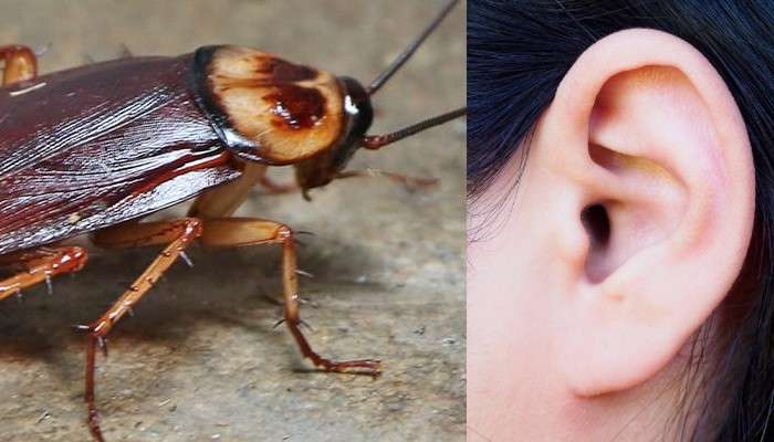 Cockroach from Ear: কান থেকে বেরিয়ে এল আস্ত এক আরশোলা! Cockroach from Ear: কান থেকে বেরিয়ে এল আস্ত এক আরশোলা!