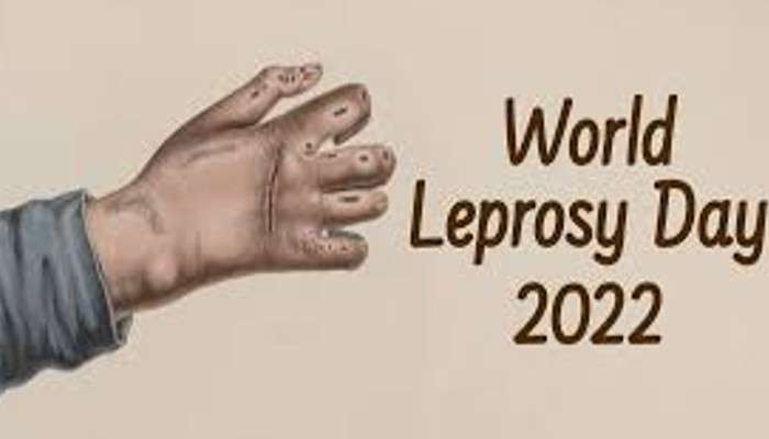 World Leprosy Day: মর্যাদাবোধে বেঁধে বেঁধে থাকা; রোগকে পরাস্ত করাই লক্ষ্য