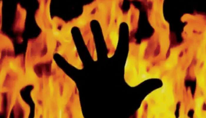 Mother burnt daughter: ভয়ঙ্কর কাণ্ড! স্বামীকে &#039;আনুগত্য&#039;-র প্রমাণ দিতে ১০ বছরের মেয়ের গায়ে আগুন গৃহবধূর
