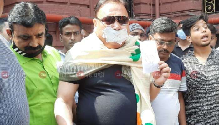 Madan Mitra: হাসপাতাল থেকে ছাড়া পেলেন মদন মিত্র, মুখে লিউকোপ্লাস্ট