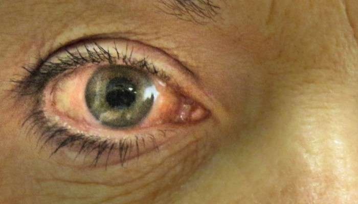World Glaucoma Day 2022: আপনার দৃষ্টিশক্তি নীরবে কে চুরি করে নেয় জানেন? সাবধান থাকুন এর নাগাল থেকে